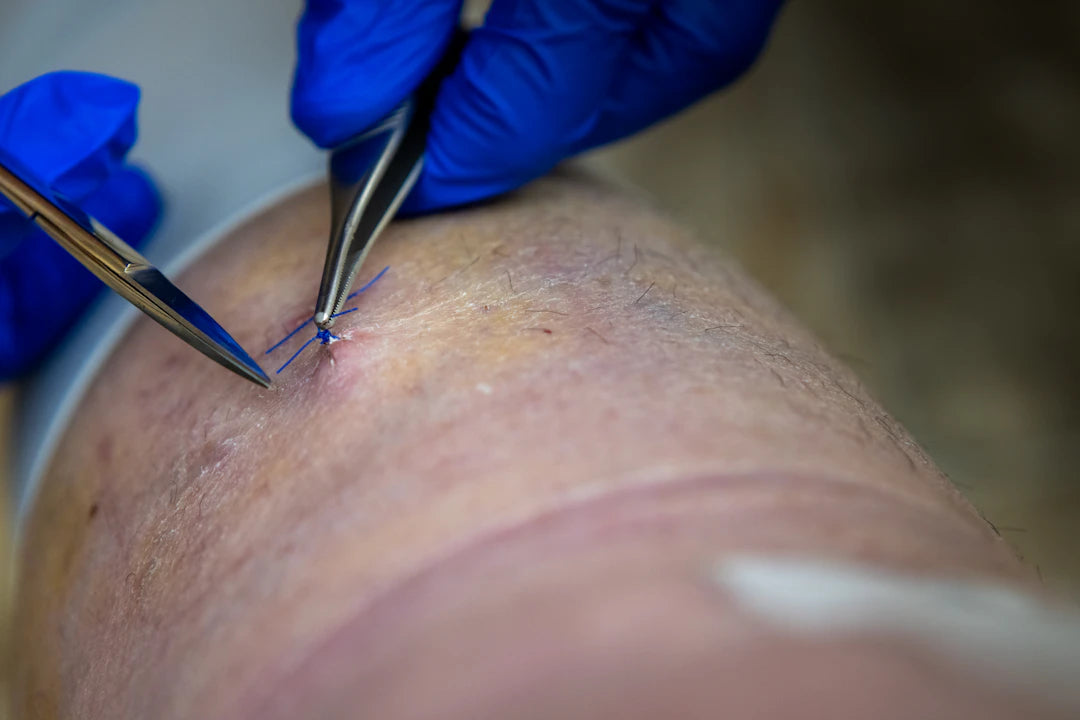 Verbeter je Gezondheid met Transdermale Supplement Patches